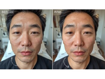 えがお鍼灸整骨院 栗東院/飲み過ぎ食べ過ぎの浮腫にも