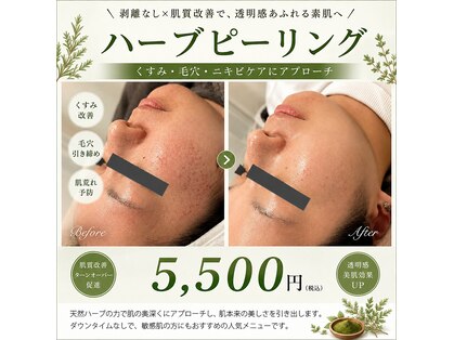 エクラ(eclat)の写真