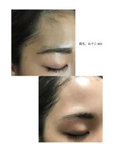 アンドエスビューティ(&S Beauty)/お顔もワックス脱毛☆