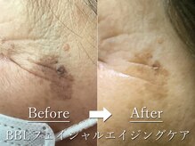 ギンレイ(GINREI)/ 【Before → After】