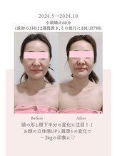 トゥインクル 麻布(twinkle)/南麻布/シンメトリー小顔矯正