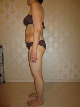 ルメートルセラピー ビューティーサロン(REMETTRE THERAPY)/60代ダイエット痩身成功例