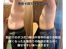 んまちの雰囲気(5回施術推薦ですが、3回でこれだけ育毛促進したお客様もいます!)