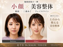 ドクターマジックタッチ(Dr.MAGIC TOUCH)