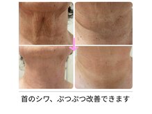 庭夢エステの雰囲気（首のシワ、シミ、ぷつぷつの改善は秋からがオススメ！）
