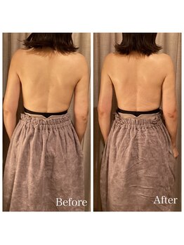 オクノマ(OKUNOMA)/【お客様BeforeAfter】