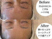 シーン(Sheen)の雰囲気（ピーリングとマッサージの相乗効果でつるんとハリ艶肌。）