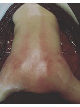 アンリ(Anli)/体が冷えと血流よく無い時