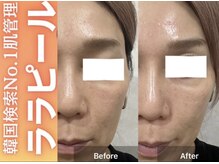 ブレア(Blair)/ララピール