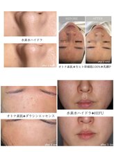 ルルアス 銀座(LuLuAS)/肌根本改善は当店へお任せ♪