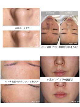 ルルアス 銀座(LuLuAS)/肌根本改善は当店へお任せ♪