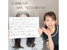 レイ(Rey)/毛穴の黒ずみが綺麗になった！