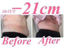 ラヴ 久屋大通店(Luv)/ちひろ様BeforeAfter