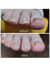 爪切り屋 足楽/