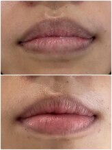 ホワイトニングショップ 奈良生駒店/ローマピンク/モニター募集