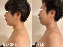 アンミー(anmiiy)/50代エアバリ変化/頭