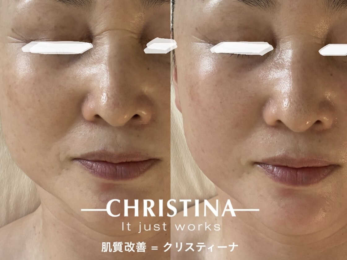 フォー(For)｜ホットペッパービューティー
