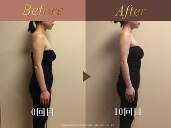 オーシャン(Ocean)/小顔整顔60分/週1回×10回