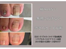 エマーブル(Aimarble)の雰囲気（岡山県内1人認定を受けているトラブルネイルケアリスト在籍）