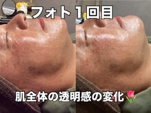 リエル(RIEL)/【フォト】