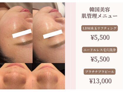 ミアンカ(mianca)の写真