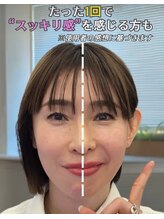 エクレクティック(ECLECTIC)/小顔マシン/テラボーラー/小顔