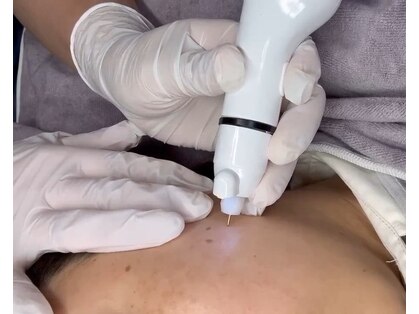 ウル(Uru)の写真