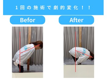 きくち整骨院/1回の施術で驚きの変化【腰痛】