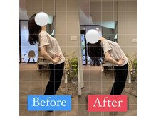 ナオル整体 宮崎院(NAORU整体)/20代女性施術事例【腰痛改善】