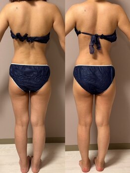 ボディラインを整えたい