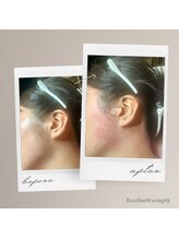 ブラジリアンワキシング シックスナイン(BrazilianWaxing69)/女性 / もみあげ