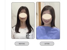 メイクビューティー(Make Beauty)/お客様のビフォーアフター