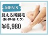 【メンズ脱毛】大人気の腕・足・脇・髭の見える箇所脱毛
