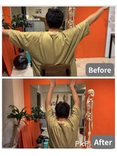 カワル整体 上通り院/肩の変化