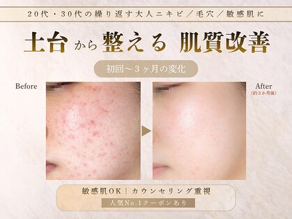 メレ(mele)の写真