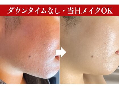 肌レボ 高田馬場店(肌REVO)の写真
