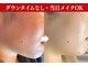 肌レボ 高田馬場店(肌REVO)の写真