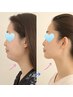 ◆【エラ・食いしばり・たるみ】頭から整える小顔整体45分★輪郭スッキリ★