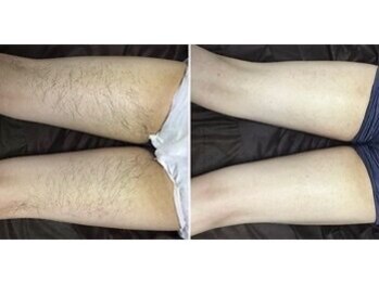 メンズ シンバ(SIMBA)/☆ ビフォーアフター ☆