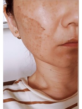 ジーニー(Genie)/脱皮中！