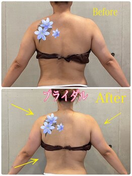 エクセレントビューティーサロン 艶(EN)/ブライダル２回