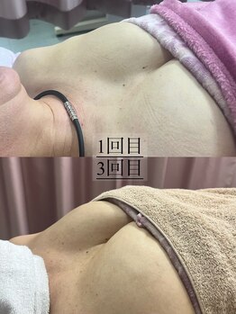 ビウラ(BIURA)/【50代】3児のママさん