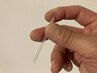 【10分拡大】過去のケガでの関節の違和感に 整体+鍼灸80分10,870円→8,670円