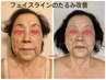 《堂々とマスク無しの自分へ!!》首肩～フェイスラインまでグイっと引き上げ★