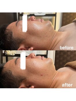 ソラ(sola*)/レモンボトル