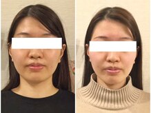 美容整体 ウェリナ 蟹江院/小顔矯正/骨盤矯正/美脚サロン