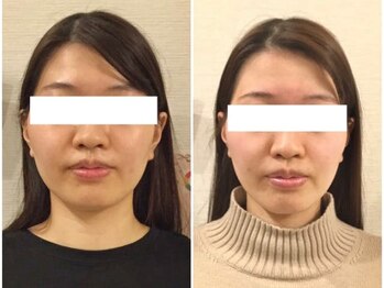 美容整体 ウェリナ 蟹江院/小顔矯正/骨盤矯正/美脚サロン