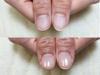 グラシナ なんば店/深爪/自爪育成/フィルイン