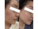 サロン アイプラス(salon i plus)の写真/完全個室の贅沢空間でお肌を徹底的にきれいに。美意識の高い結果にこだわる大人女性のための集中肌質改善◎