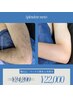 【メンズ脱毛　両腕】ワックス脱毛&光脱毛